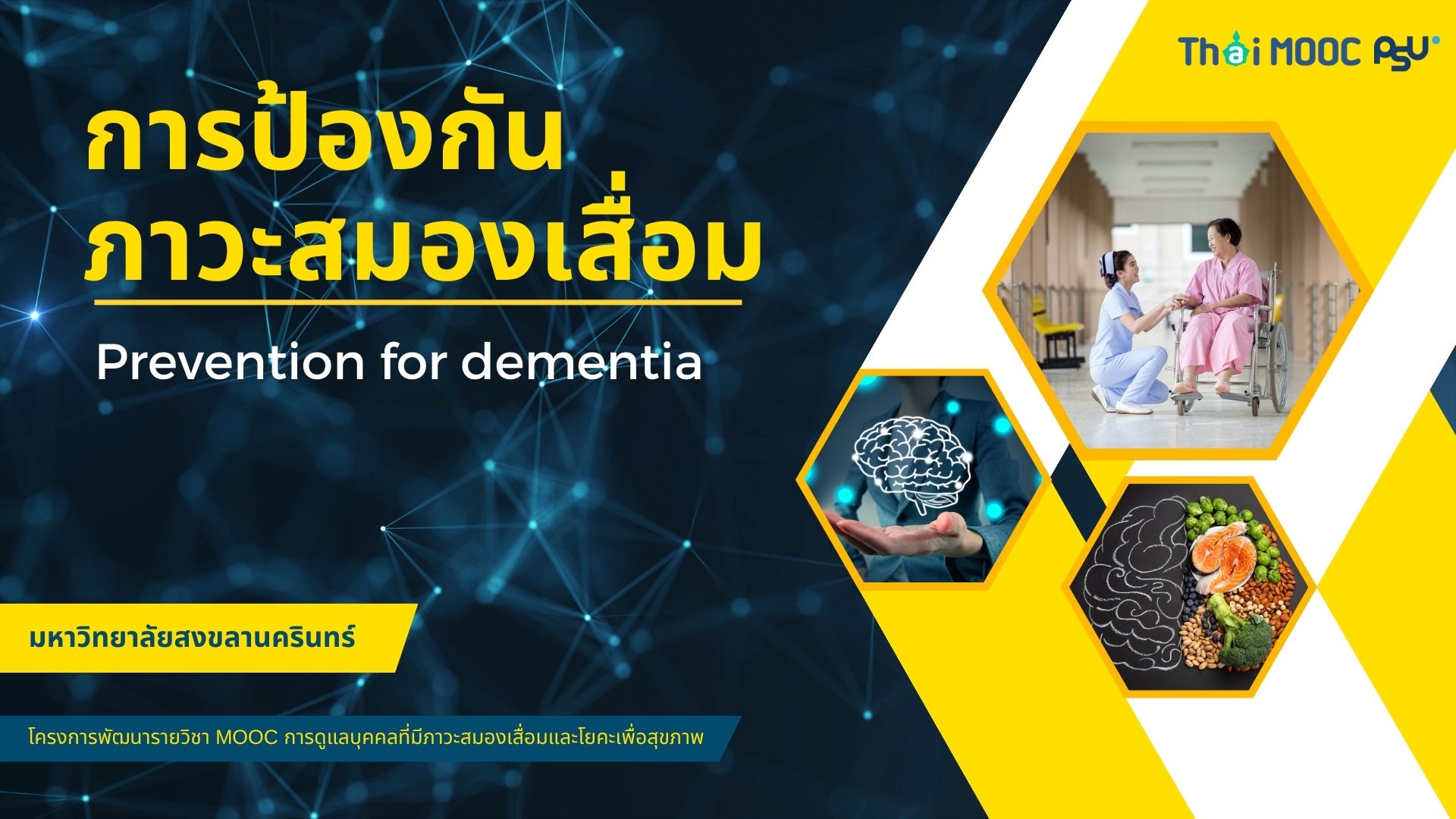 การป้องกันภาวะสมองเสื่อม | Prevention for dementia 00524